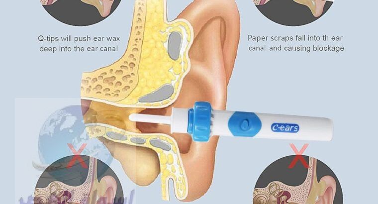 جهاز تنضيف الاذن بواسطة الشفط