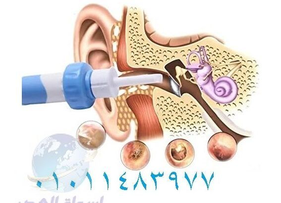 جهاز تنضيف الاذن بواسطة الشفط